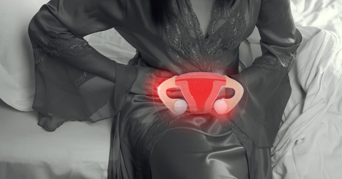 endometriosis